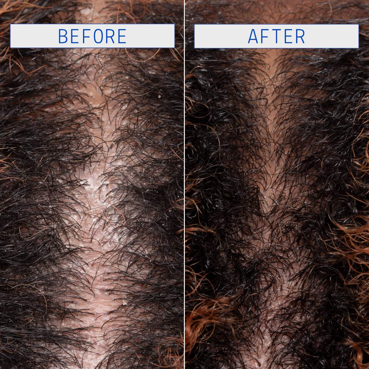 Curling Perfection, Defining Purifies Scalp Set of 2