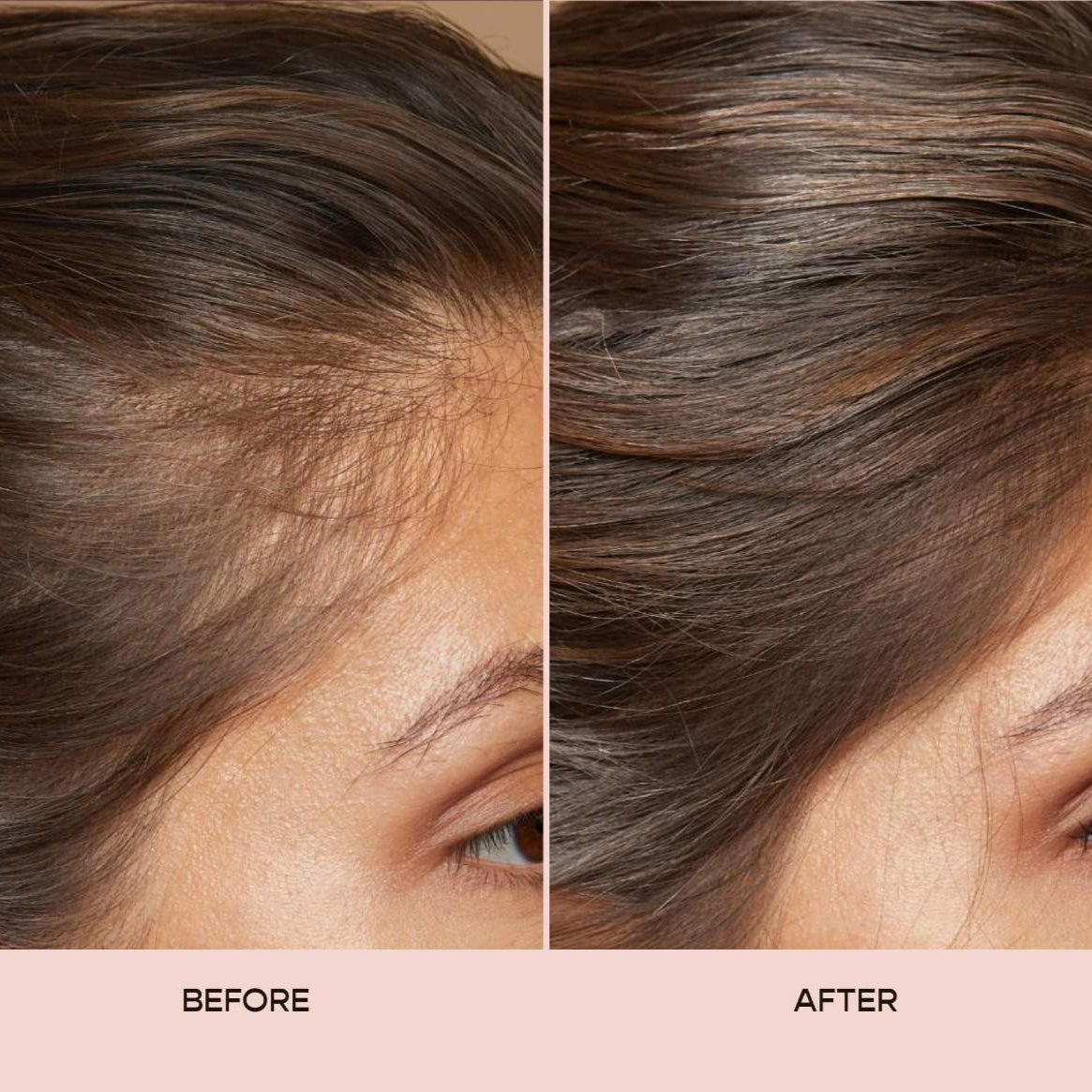 Onion Biotin Hair Growth Shampoo and Conditioner Set