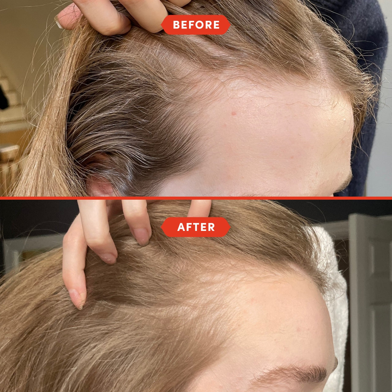 100% Pure Rosemary Oil For Hair Growth