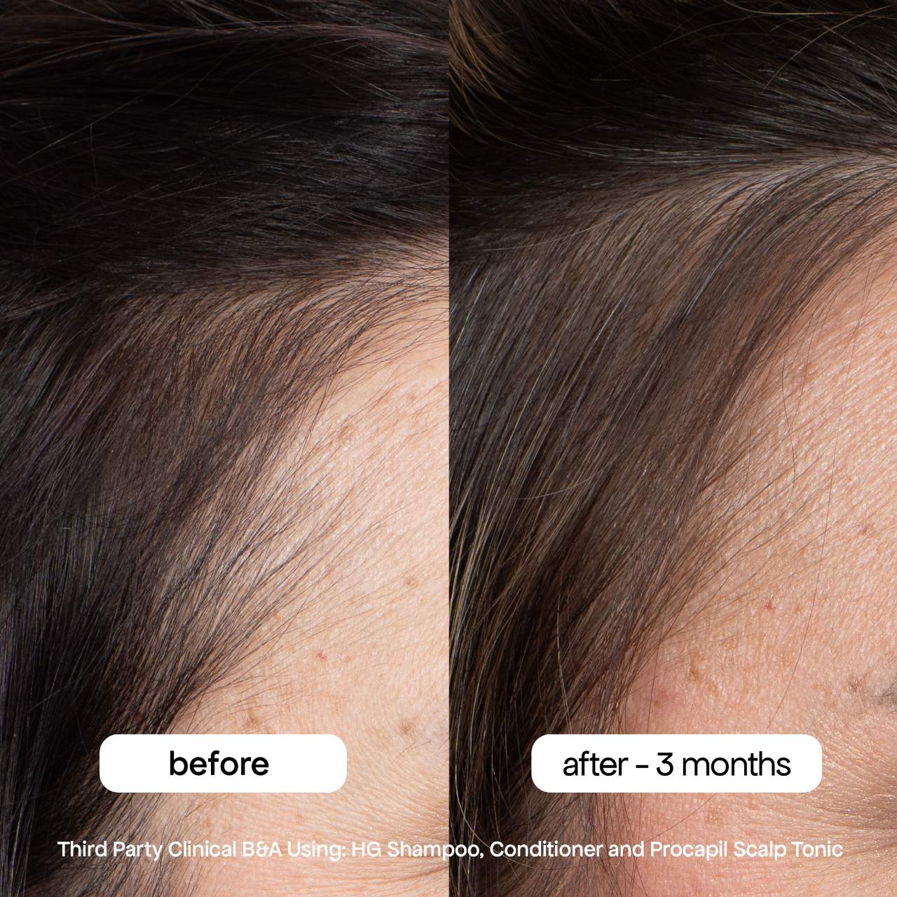 Revitalizing Scalp Tonic Treatment for Thinning Hair
