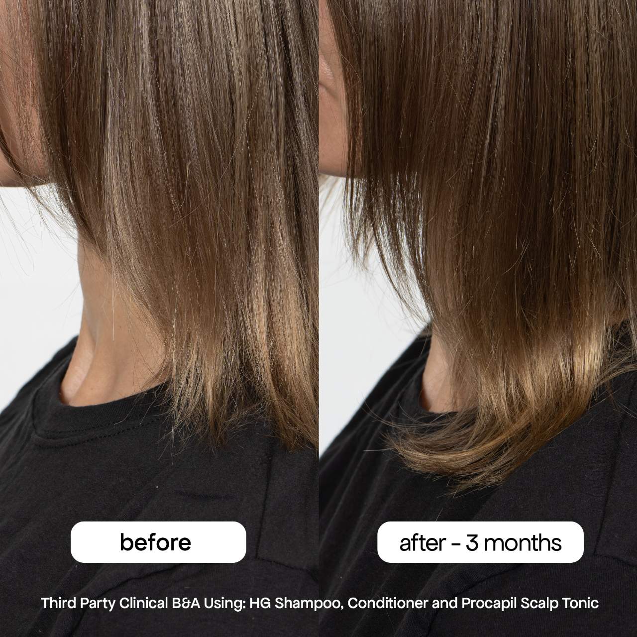 Revitalizing Scalp Tonic Treatment for Thinning Hair